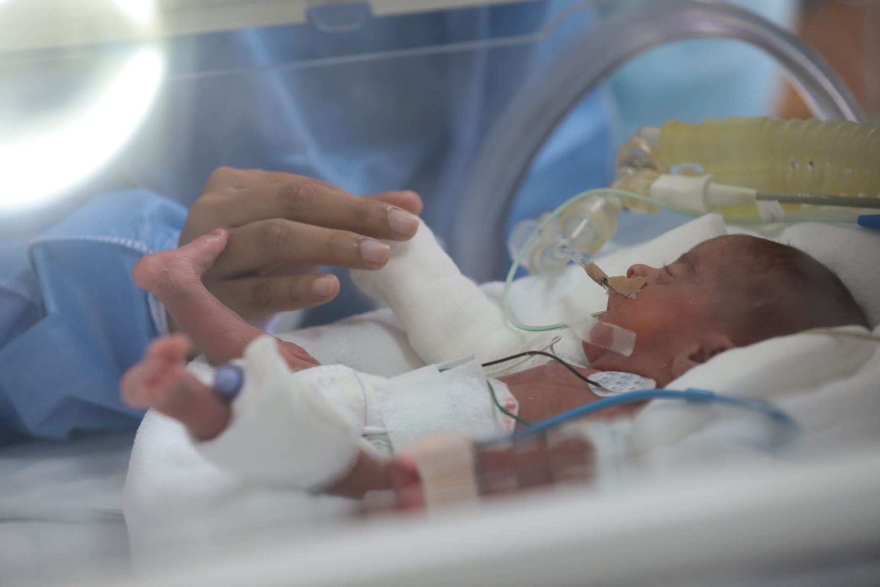 ¡ALARMA ROJA! Virus Ataca Bebés Peruanos: ¿Qué Padres Deben Saber YA?